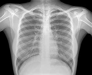 When Should You Get an X-Ray?